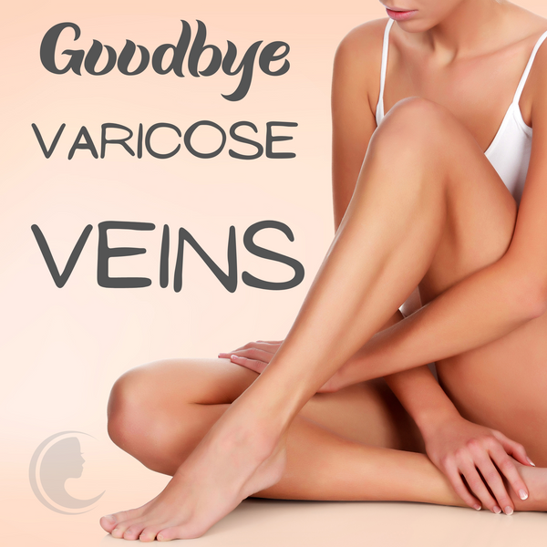 Say Goodbye To Varicose Veins