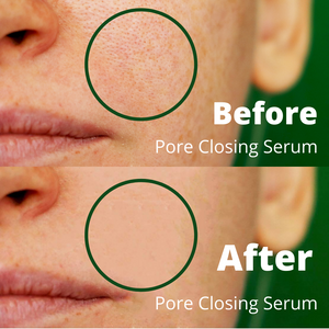 pore closing serum, pore refining serum, best pore closing serum, best pore diminishing serum, natural organic skincare, best skincare, best natural organic skincare,