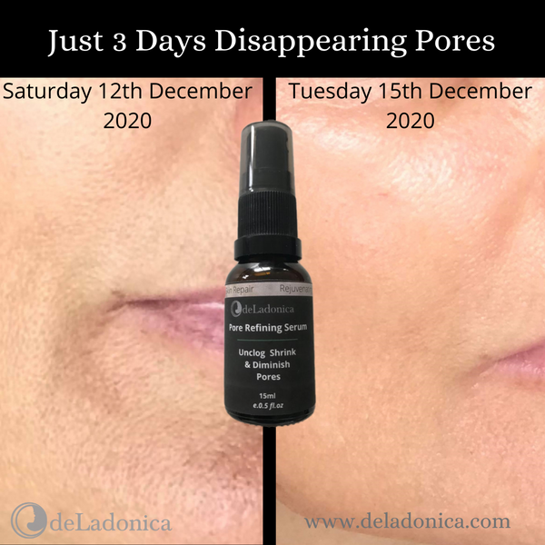 ENLARGED PORES?   OH, NO YOU DON’T!!!